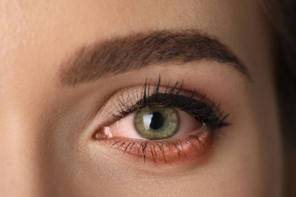 closeup-of-irritated-eye